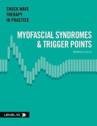 Full Download Myofascial Syndromes & Trigger Points (Shock Wave Therapy in Practice) - Markus Gleitz | ePub