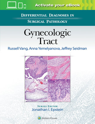 Full Download Differential Diagnoses in Surgical Pathology: Gynecologic Tract - Russel Vang | ePub