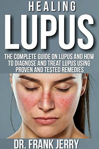Read Healing Lupus: The Complete Guide on Lupus and How to diagnose and Treat Lupus using Proven and Tested Remedies - Doctor Frank Jerry file in ePub