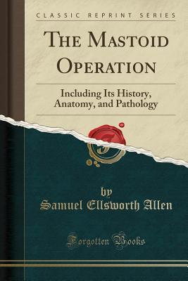 Read Online The Mastoid Operation: Including Its History, Anatomy, and Pathology (Classic Reprint) - Samuel Ellsworth Allen | PDF